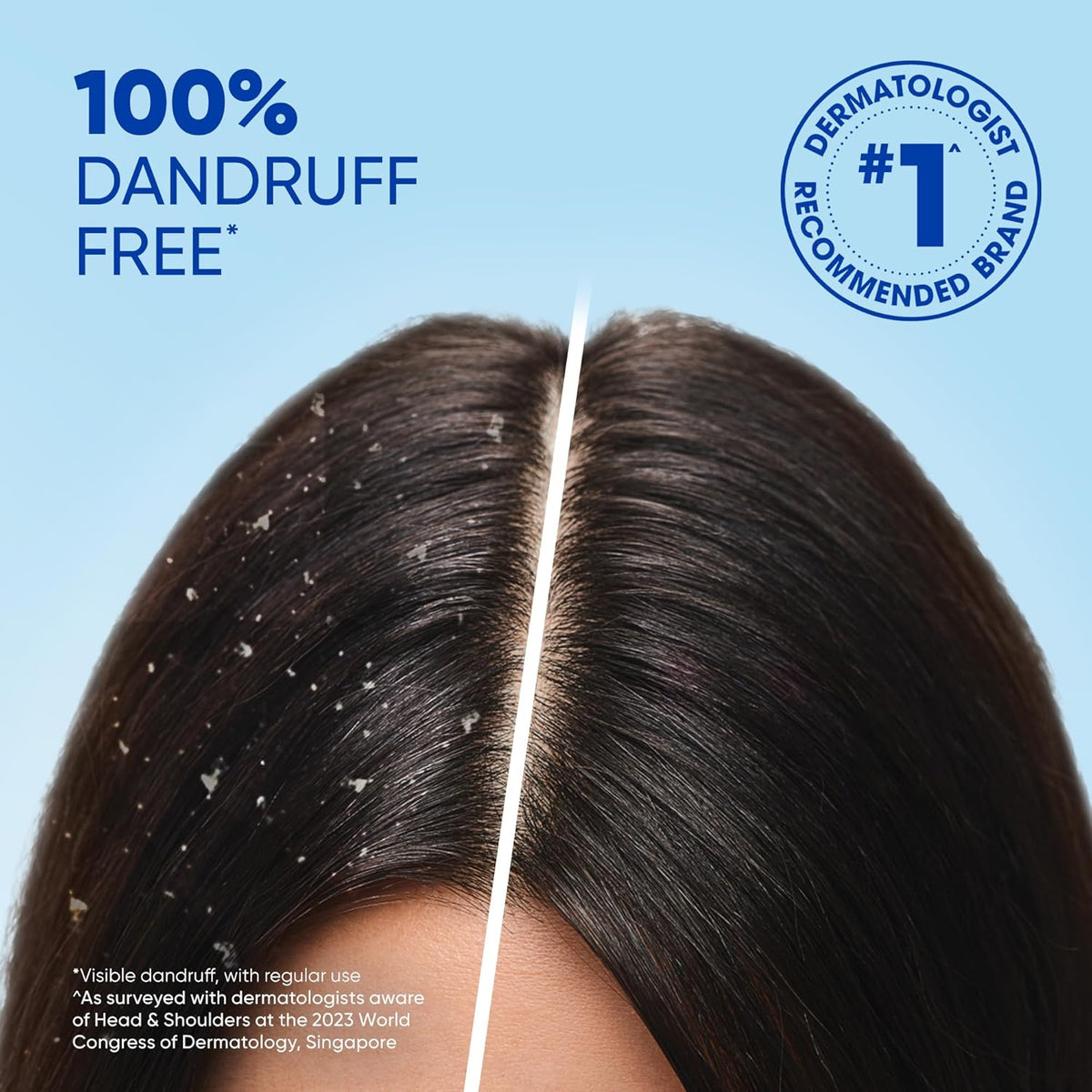Head & Shoulders Daily Clean Anti-Dandruff Shampoo 190 ml