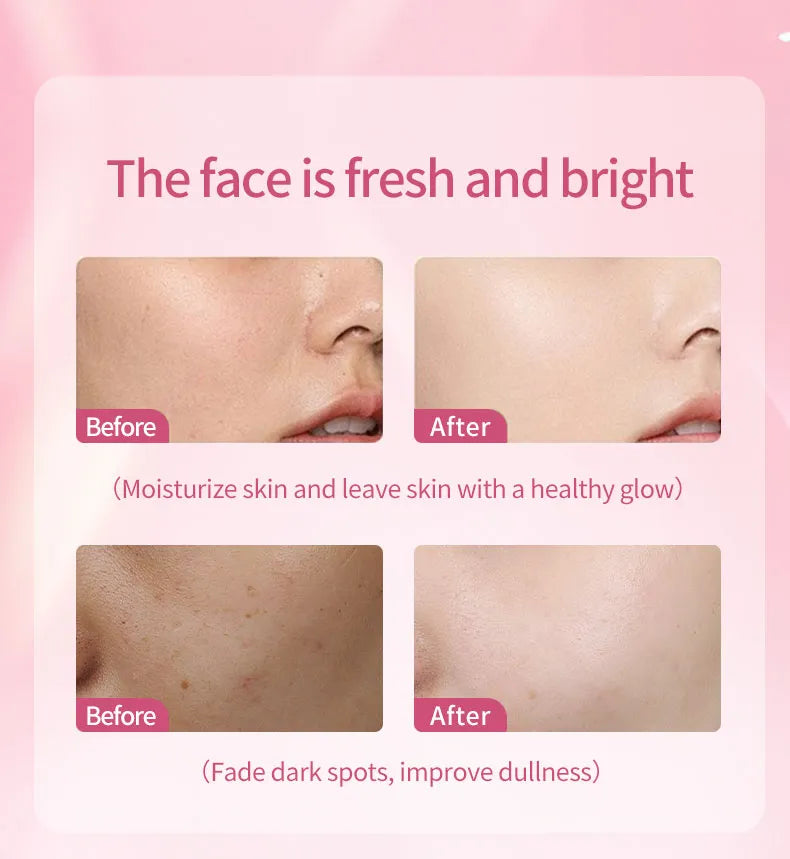 Estelin Alpha Arbutin + Niacinamide Whitening Cream 200g