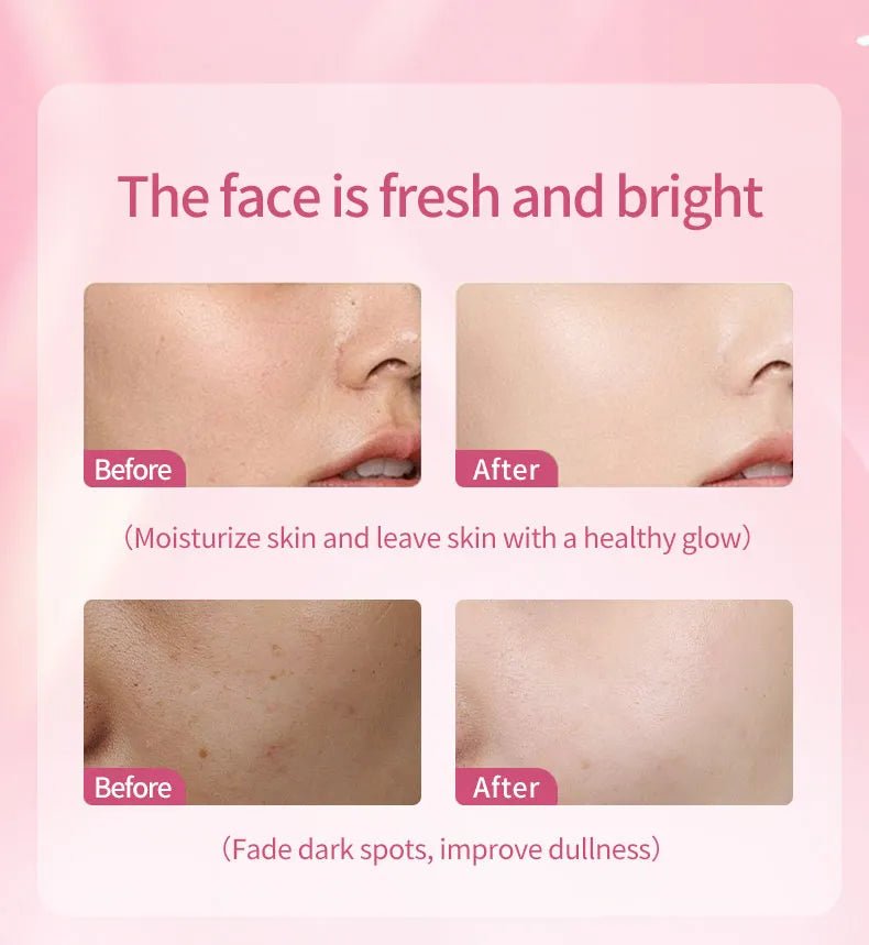 Estelin Alpha Arbutin + Niacinamide Whitening Cream 200g - Al Kabayel Discount CentreEstelin Alpha Arbutin + Niacinamide Whitening Cream 200gSkin CareESTELINAl Kabayel Discount Centre